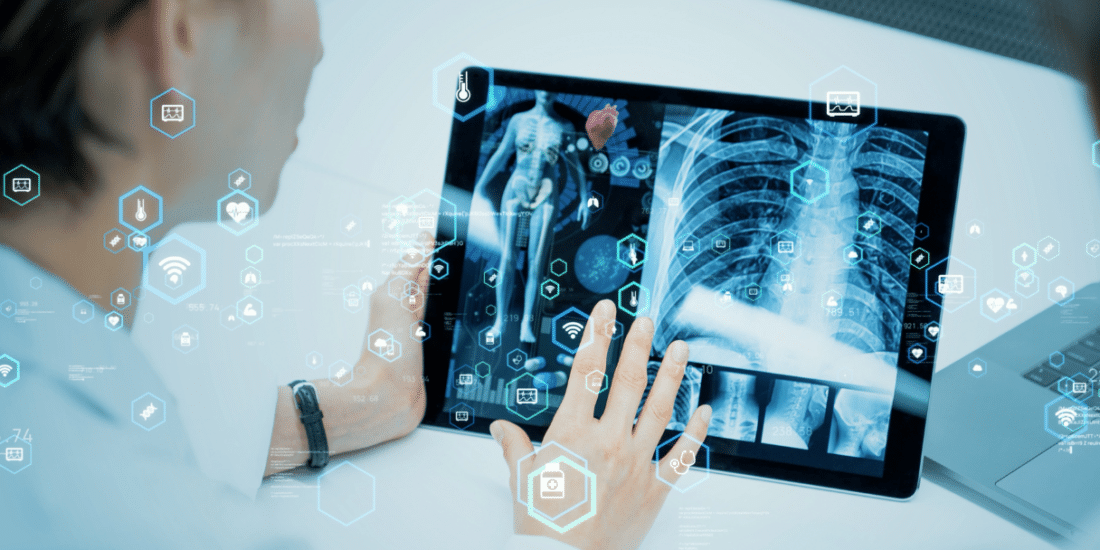 Lab doctor with tablet showing a xray of ribs - MDL Technology